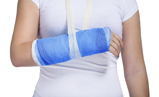 broken arm